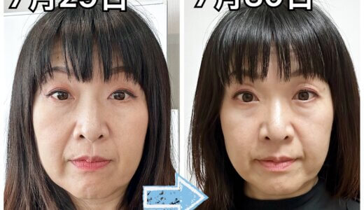 劇的スキルアップ！佐藤先生による上級骨格矯正講座を受講しました！